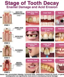 Insideefy® Cavity-Repair Natural Enamel Filling Gel